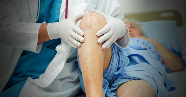 Knee Replacement Surgery